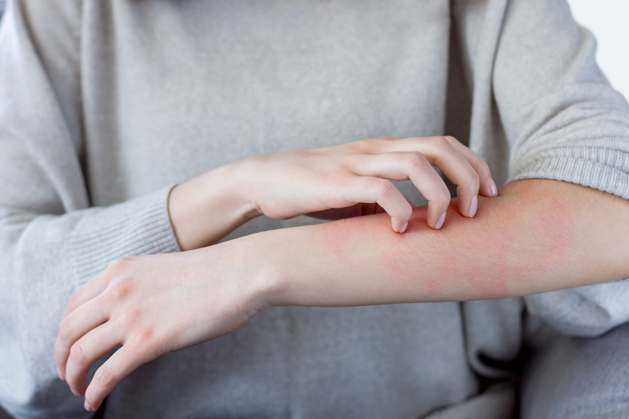 Die Mastzelle und ihre Hauptrolle bei Allergien